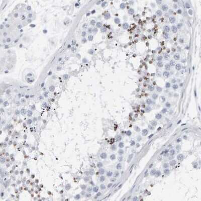Immunohistochemistry-Paraffin: SPACA3 Antibody [NBP1-89136]