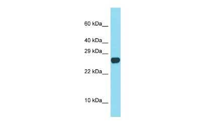 Western Blot: SPACA3 Antibody [NBP2-83578]