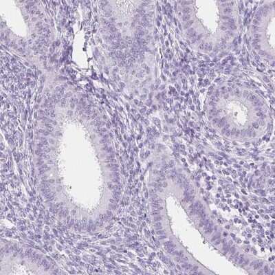 Immunohistochemistry-Paraffin: SPACA4 Antibody [NBP1-80793]