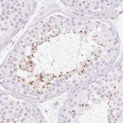 Immunohistochemistry-Paraffin: SPACA4 Antibody [NBP1-80793]