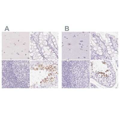 Immunohistochemistry-Paraffin: SPACA4 Antibody [NBP1-80793]