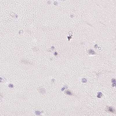 Immunohistochemistry-Paraffin: SPACA4 Antibody [NBP1-80793]