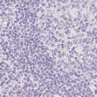 Immunohistochemistry-Paraffin: SPACA4 Antibody [NBP1-80793]