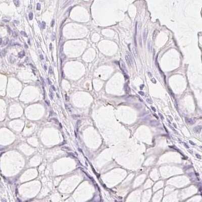Immunohistochemistry-Paraffin: SPACA4 Antibody [NBP1-80793]