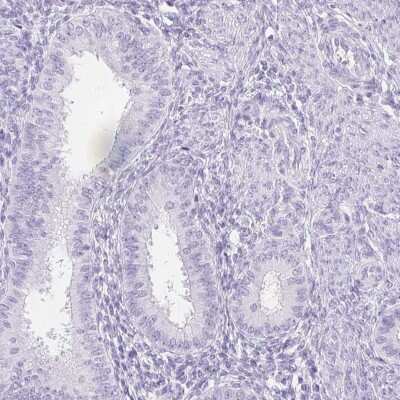 Immunohistochemistry-Paraffin: SPACA4 Antibody [NBP2-38913]
