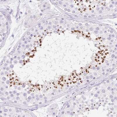 Immunohistochemistry-Paraffin: SPACA4 Antibody [NBP2-38913]
