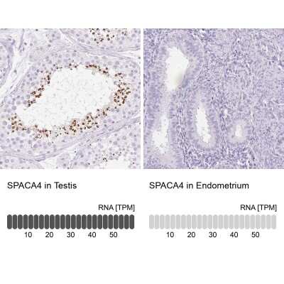 Immunohistochemistry-Paraffin: SPACA4 Antibody [NBP2-38913]