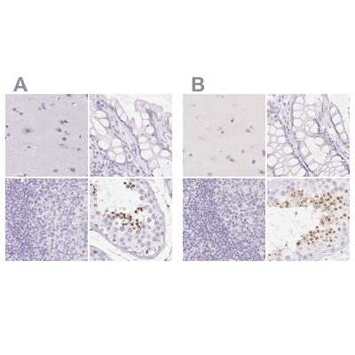 Immunohistochemistry-Paraffin: SPACA4 Antibody [NBP2-38913]