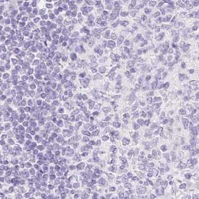 Immunohistochemistry-Paraffin: SPACA4 Antibody [NBP2-38913]