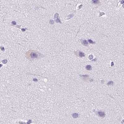 Immunohistochemistry-Paraffin: SPACA4 Antibody [NBP2-38913]