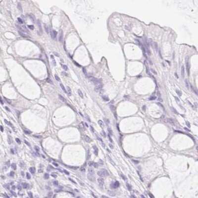 Immunohistochemistry-Paraffin: SPACA4 Antibody [NBP2-38913]