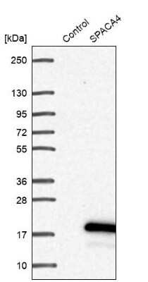 Western Blot: SPACA4 Antibody [NBP1-80793]