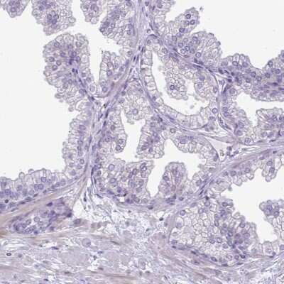 Immunohistochemistry-Paraffin: SPAG1 Antibody [NBP2-38707]