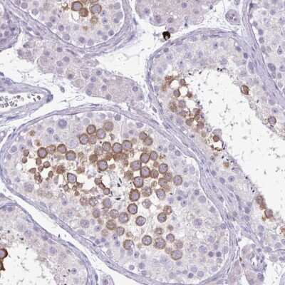 Immunohistochemistry-Paraffin: SPAG1 Antibody [NBP2-38707]