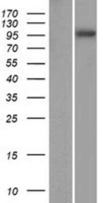 Western Blot: SPAG1 Overexpression Lysate [NBP2-08036]