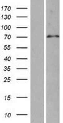 Western Blot: SPAG16 Overexpression Lysate [NBP2-06322]