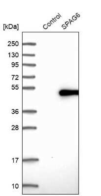 Western Blot: SPAG6 Antibody [NBP1-80923]