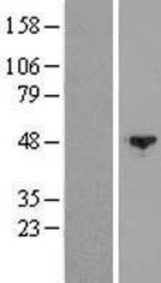 Western Blot: SPAG6 Overexpression Lysate [NBL1-16366]