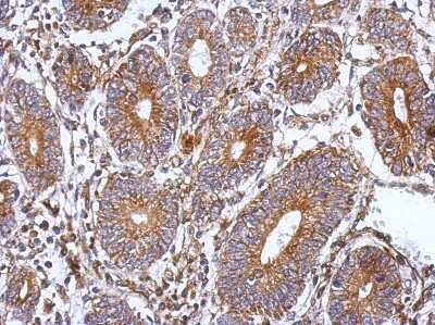 Immunohistochemistry-Paraffin: SPAG8 Antibody [NBP2-20464]