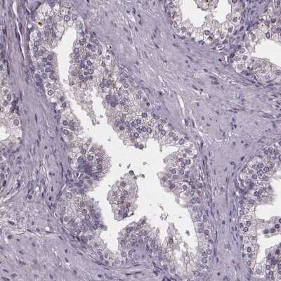 Immunohistochemistry-Paraffin: SPAG8 Antibody [NBP2-39092]
