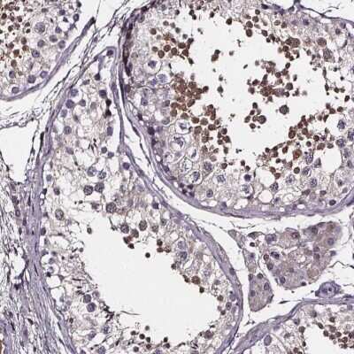Immunohistochemistry-Paraffin: SPAG8 Antibody [NBP2-39092]