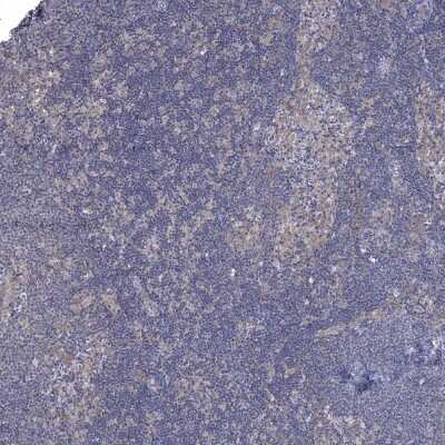 Immunohistochemistry-Paraffin: SPAG9 Antibody [NBP1-85393]