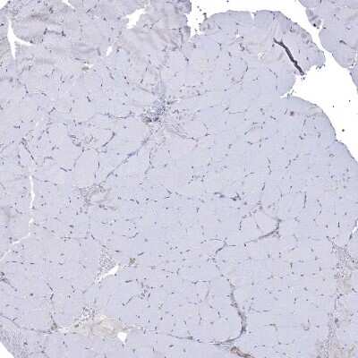 Immunohistochemistry-Paraffin: SPAG9 Antibody [NBP1-85393]