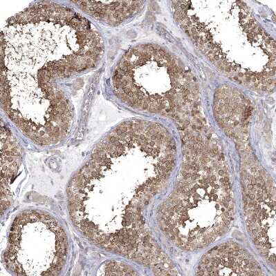 Immunohistochemistry-Paraffin: SPAG9 Antibody [NBP1-85393]
