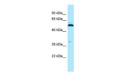 Western Blot: SPAM1 Antibody [NBP2-83579]