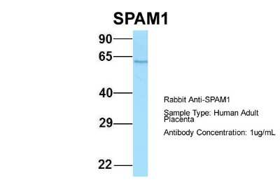 Western Blot: SPAM1 Antibody [NBP2-83579]