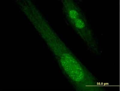 Immunocytochemistry/ Immunofluorescence: SPANXB1 Antibody [H00728695-B01P]