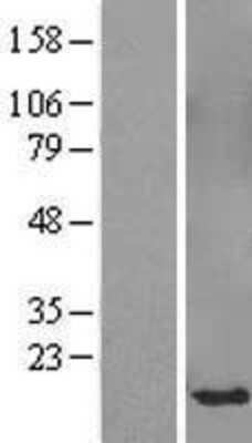 Western Blot: SPANXB1 Overexpression Lysate [NBL1-16370]