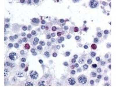 Immunohistochemistry: SPANXC Antibody [NBP1-77925]