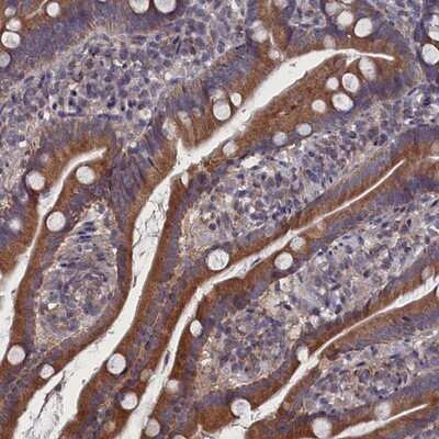 Immunohistochemistry-Paraffin: SPATA13 Antibody [NBP1-90849]