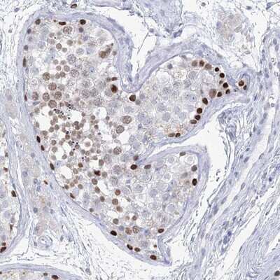 Immunohistochemistry-Paraffin: SPATA16 Antibody [NBP2-13368]