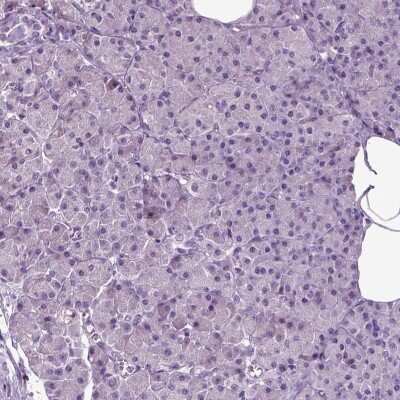 Immunohistochemistry-Paraffin: SPATA17 Antibody [NBP1-83097]