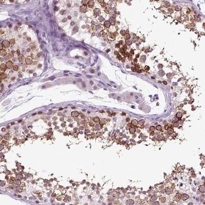 Immunohistochemistry-Paraffin: SPATA17 Antibody [NBP1-83097]