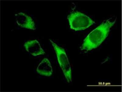 Immunocytochemistry/ Immunofluorescence: SPATA2 Antibody (1F1) [H00009825-M01]