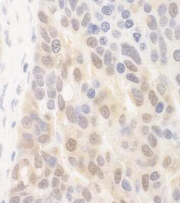 Immunohistochemistry: SPATA2 Antibody [NBP2-04071]
