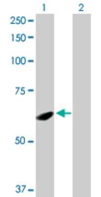 Western Blot: SPATA2 Antibody [H00009825-D01P]