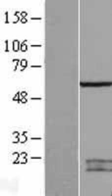 Western Blot: SPATA2 Overexpression Lysate [NBL1-16378]