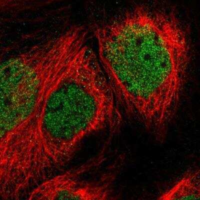 Immunocytochemistry/ Immunofluorescence: SPATA20 Antibody [NBP1-82147]