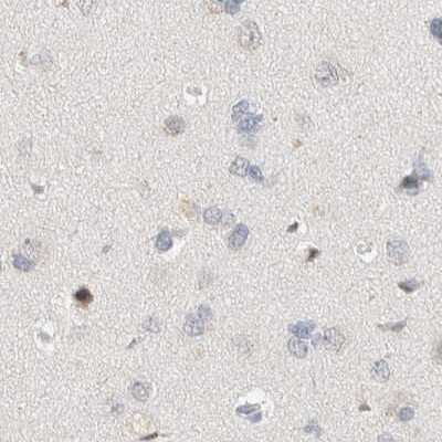 Immunohistochemistry-Paraffin: SPATA20 Antibody [NBP1-82146]