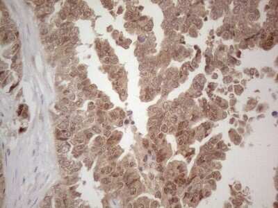 Immunohistochemistry: SPATA22 Antibody (OTI6H9) [NBP2-45939]