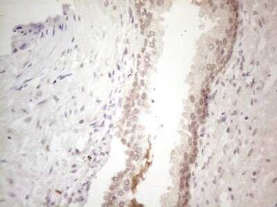 Immunohistochemistry: SPATA22 Antibody (OTI6H9) [NBP2-45939]