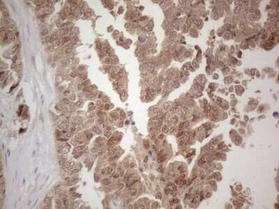 Immunohistochemistry: SPATA22 Antibody (OTI6H9) - Azide and BSA Free [NBP2-74309]