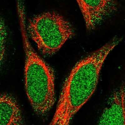 Immunocytochemistry/ Immunofluorescence: SPATA24 Antibody [NBP1-92429]