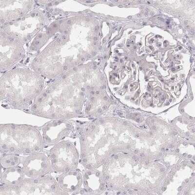 Immunohistochemistry-Paraffin: SPATA24 Antibody [NBP1-92429]