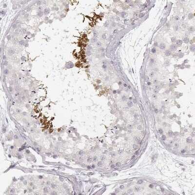 Immunohistochemistry-Paraffin: SPATA24 Antibody [NBP1-92429]