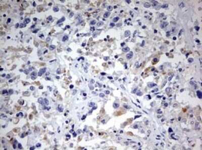 Immunohistochemistry: SPATA2L Antibody (OTI3F6) [NBP2-45940]